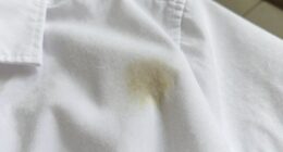 deodorant stain removal techniques